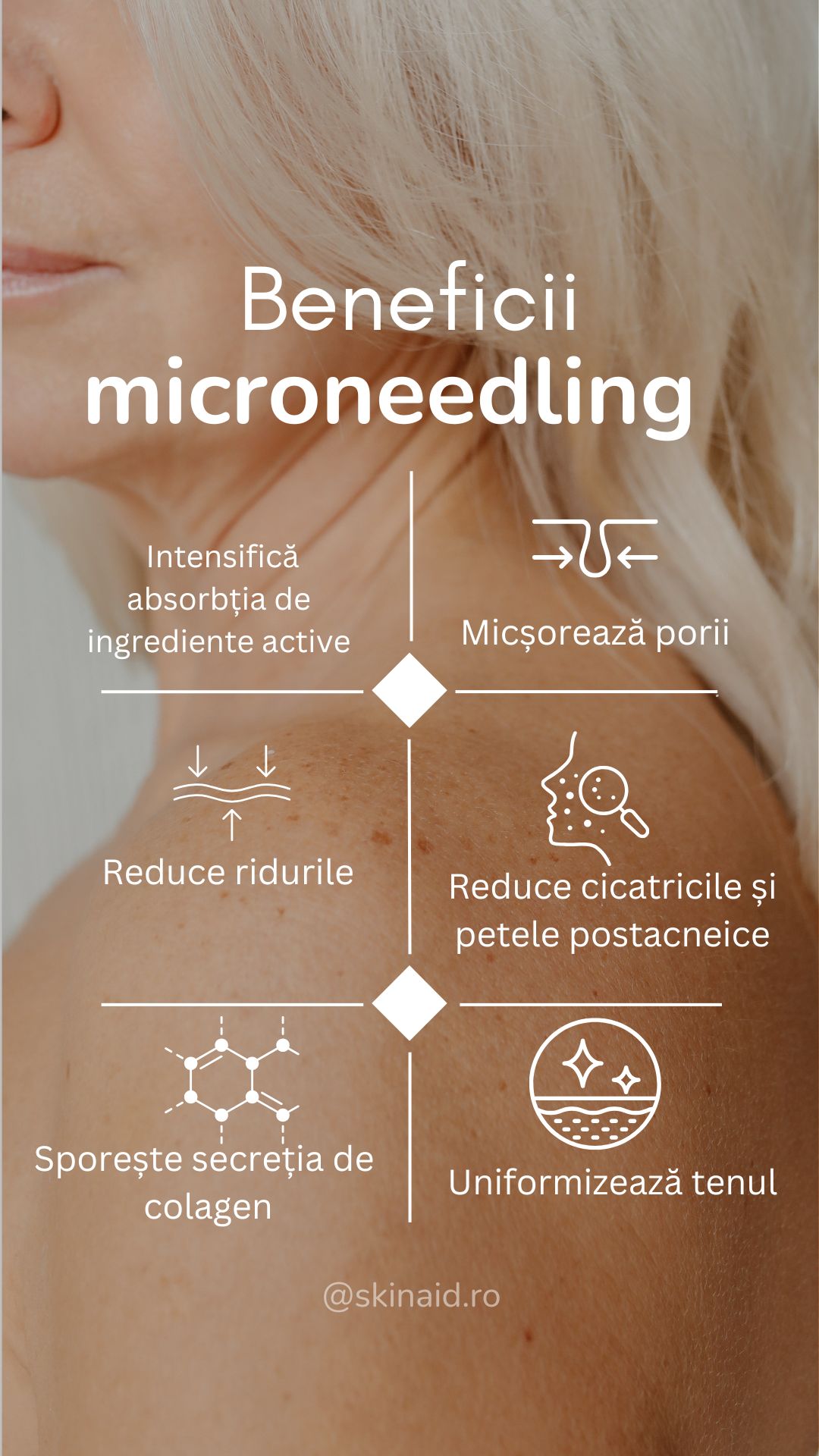 salon cosmetica sibiu Beneficii microneedling