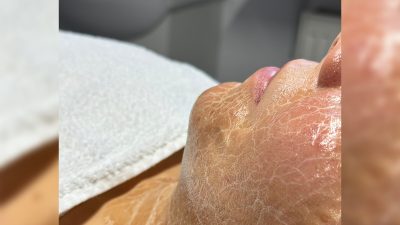 masca cu peptide tratament cosmetic