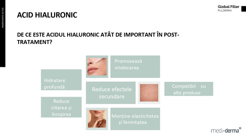 salon cosmetica sibiu global filler fillderma 34